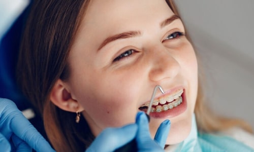 what is Laser Dentistry