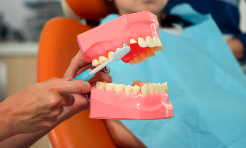 How Strong are Crowns on Front Teeth